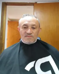 Cliente grisalho e sem barba antes da aplicação, com o topo da cabeça rarefeito