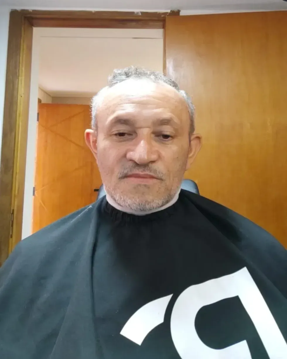 Cliente grisalho e sem barba antes da aplicação, com o topo da cabeça rarefeito
