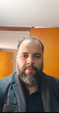 Cliente de cabelo castanho e barba antes da aplicação, com rarefação no topo da cabeça