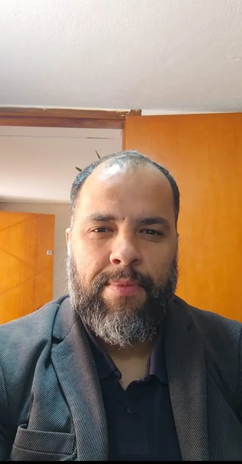 Cliente de cabelo castanho e barba antes da aplicação, com rarefação no topo da cabeça