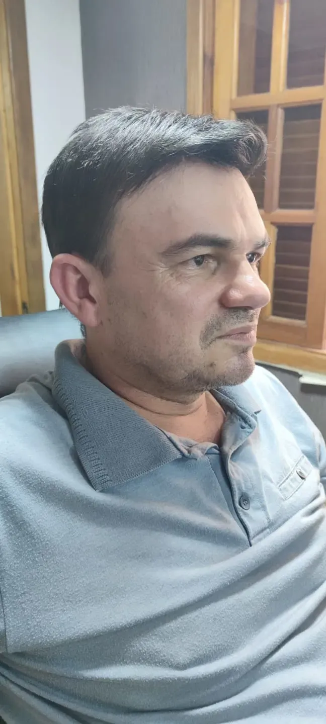 Acabamento lateral da prótese capilar masculina, integrado ao cabelo natural